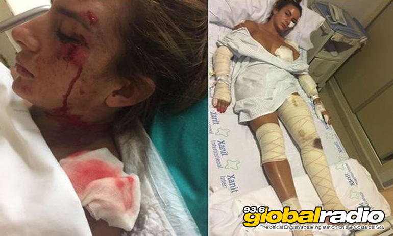 Witnesses Sought After Benalmadena Hit And Run
