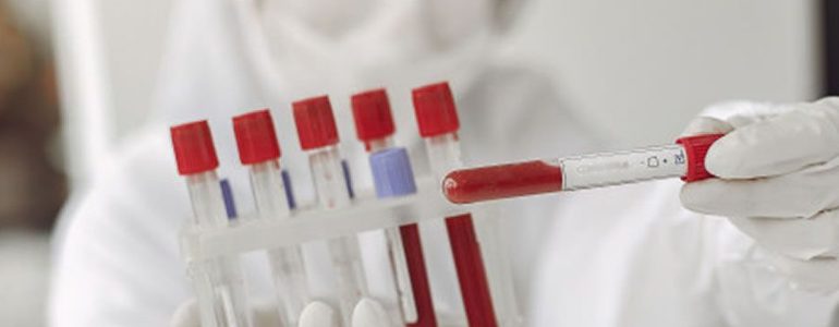 Coronavirus Cases Rising In Malaga Province